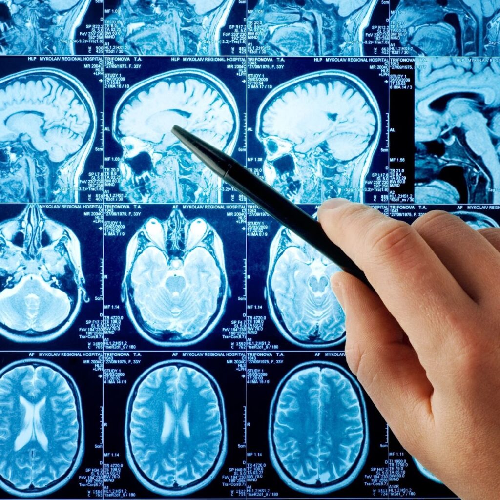 Brain and Spine Injury Specialist